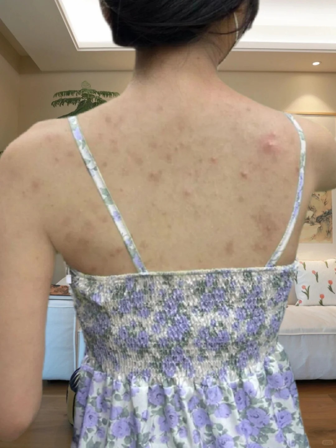 Từ mụn sần sùi, lưng tôi đã "nhẵn nhụi" hoàn toàn nhờ món đồ rẻ tiền này!- Ảnh 2.