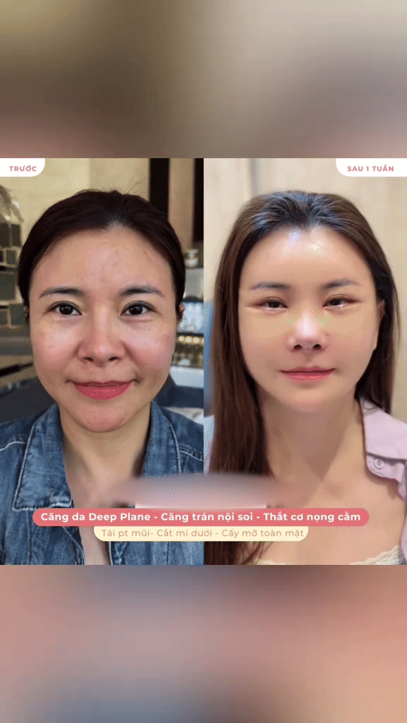 Diễn viên Vbiz 