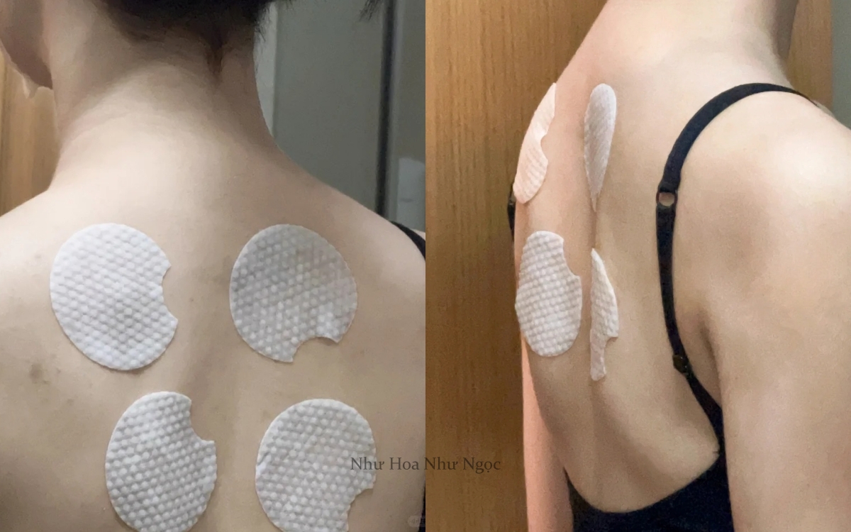 Từ mụn sần sùi, lưng tôi đã "nhẵn nhụi" hoàn toàn nhờ món đồ rẻ tiền này!- Ảnh 3.