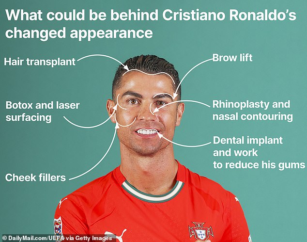 Ronaldo 40 tuổi vẫn đẹp trai cực phẩm, bác sĩ thẩm mỹ khui loạt bí mật 