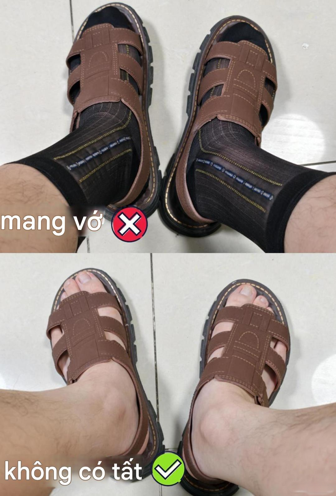 Thảm họa mặc xấu của đàn ông trung niên: Tất   dép chỉ ở hạng 2, kiểu số 1 đúng nghĩa 