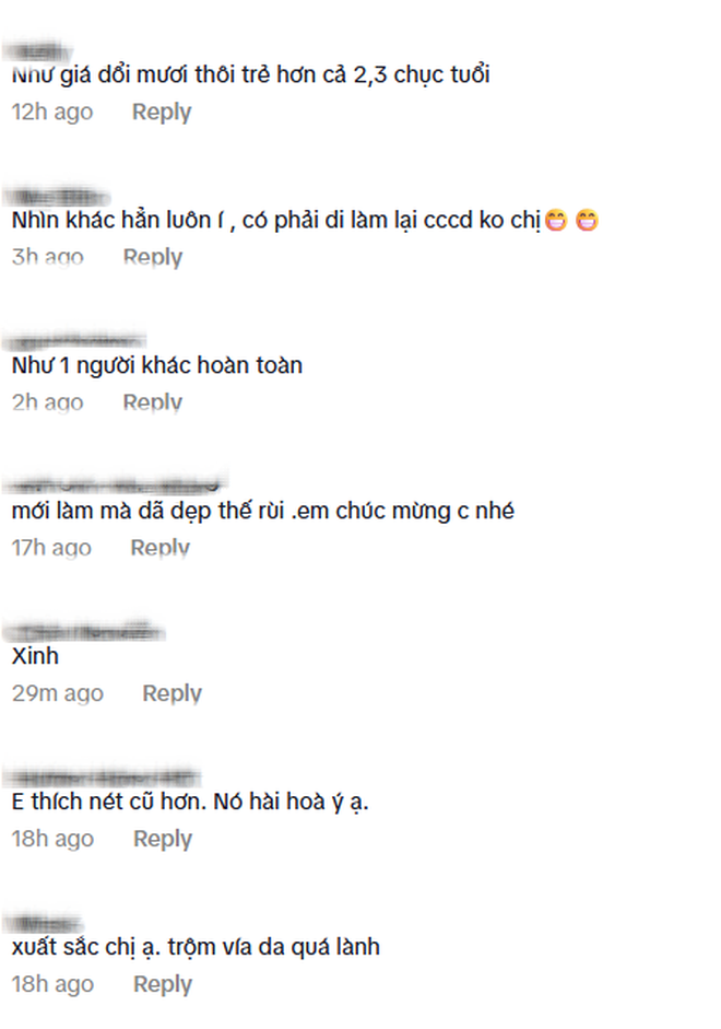 "Ác nữ" màn ảnh Việt công khai mặt sau thẩm mỹ: Khác quá không thể nhận ra- Ảnh 4.