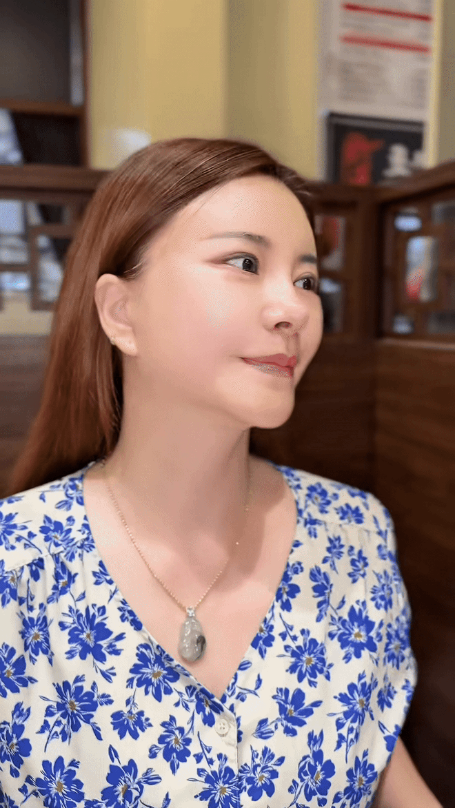 "Ác nữ" màn ảnh Việt công khai mặt sau thẩm mỹ: Khác quá không thể nhận ra- Ảnh 2.