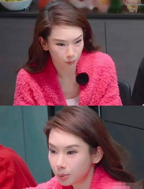 Nữ diễn viên nổi tiếng thừa nhận gương mặt "cứng đờ" vì tiêm botox quá liều, bác sĩ cảnh báo: 0,00000005 gram chất này có thể gây tử vong- Ảnh 2.