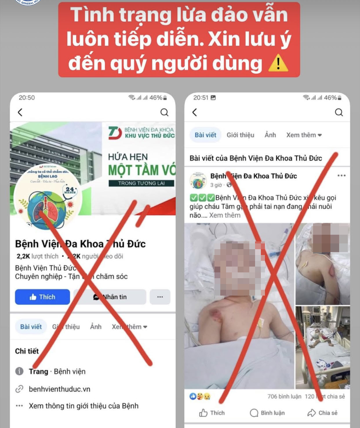 Dựng chuyện cháu bé gặp tai nạn thương tâm để kêu gọi từ thiện- Ảnh 1.