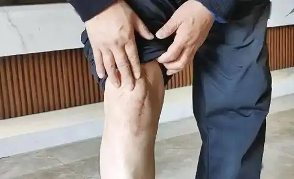 Đàn ông có già đi hay không, nhìn 