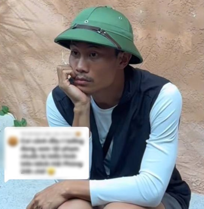 Màn huỷ dung sốc nhất Mưa Đỏ: Ngoài đời là cực phẩm nam thần, lên phim đầu chi chít sẹo nhìn mà choáng- Ảnh 3.