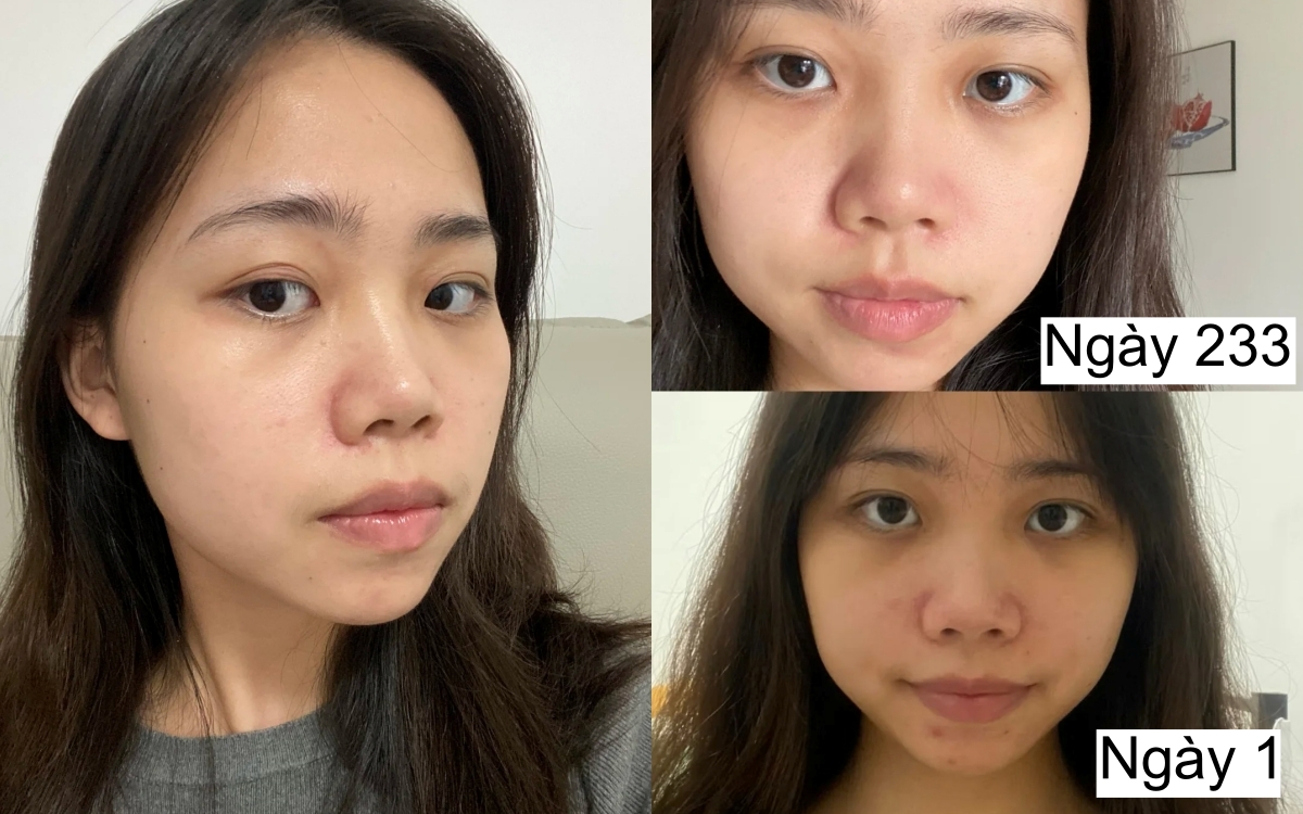 7 tháng tự dưỡng trắng da tại nhà, cô nàng nhận kết quả không thể mỹ mãn hơn- Ảnh 1.