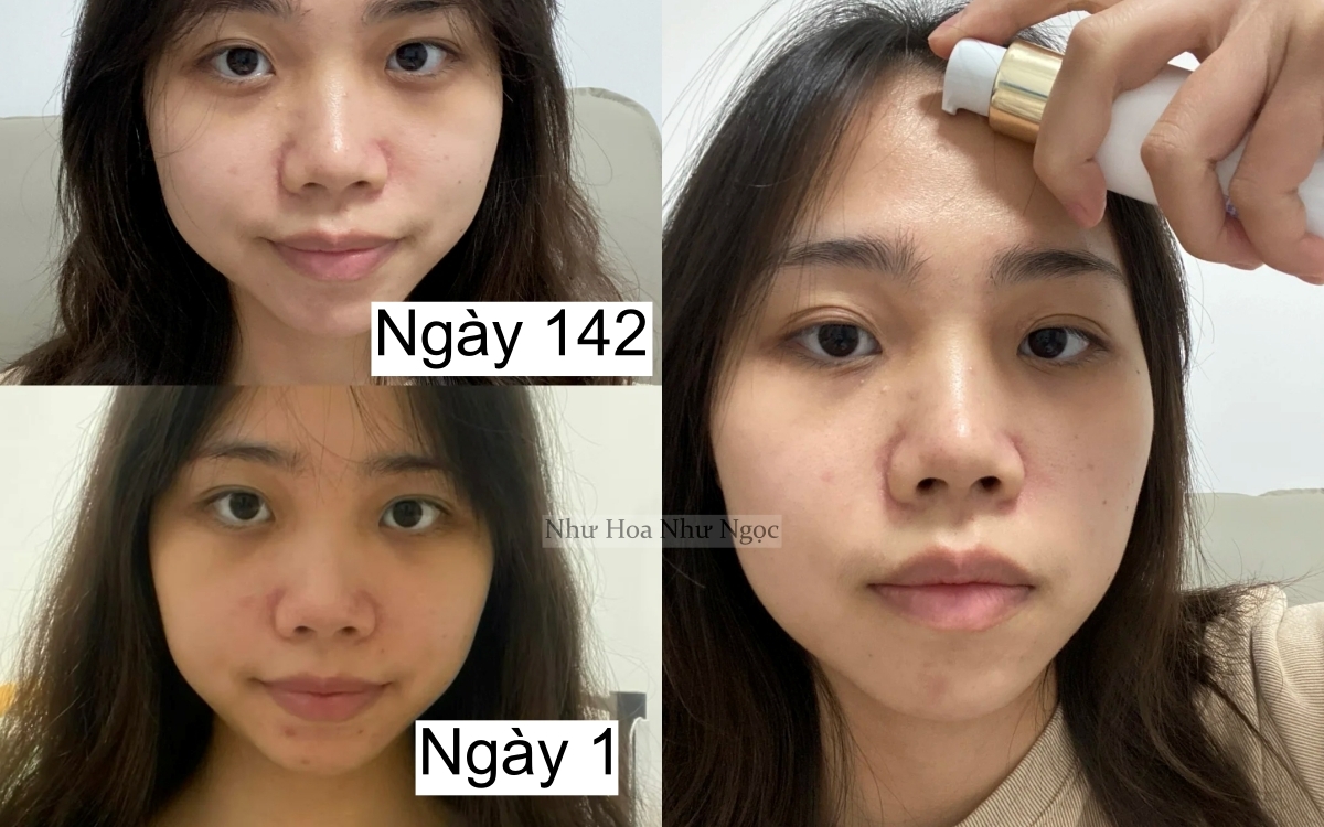 7 tháng tự dưỡng trắng da tại nhà, cô nàng nhận kết quả không thể mỹ mãn hơn- Ảnh 2.