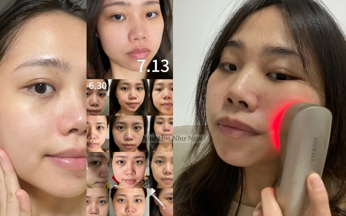 7 tháng tự dưỡng trắng da tại nhà, cô nàng nhận kết quả không thể mỹ mãn hơn- Ảnh 3.
