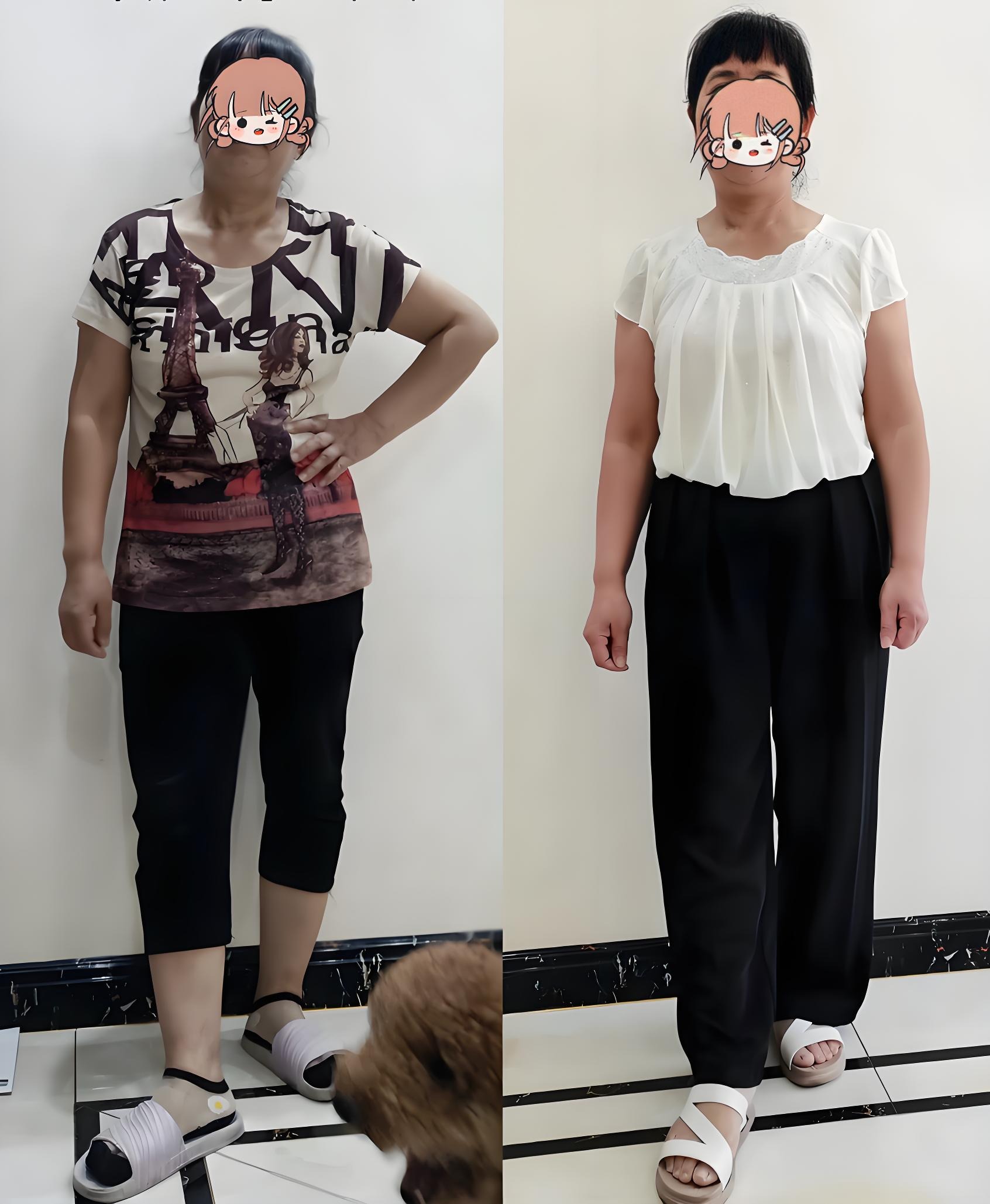 3 kiểu quần là 