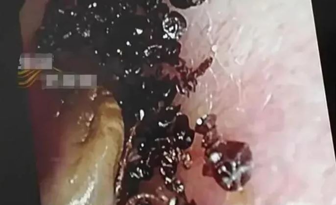 Bé gái 2 tuổi đi khám vì đau tai, bác sĩ phát hiện "bí mật đáng sợ"- Ảnh 1.