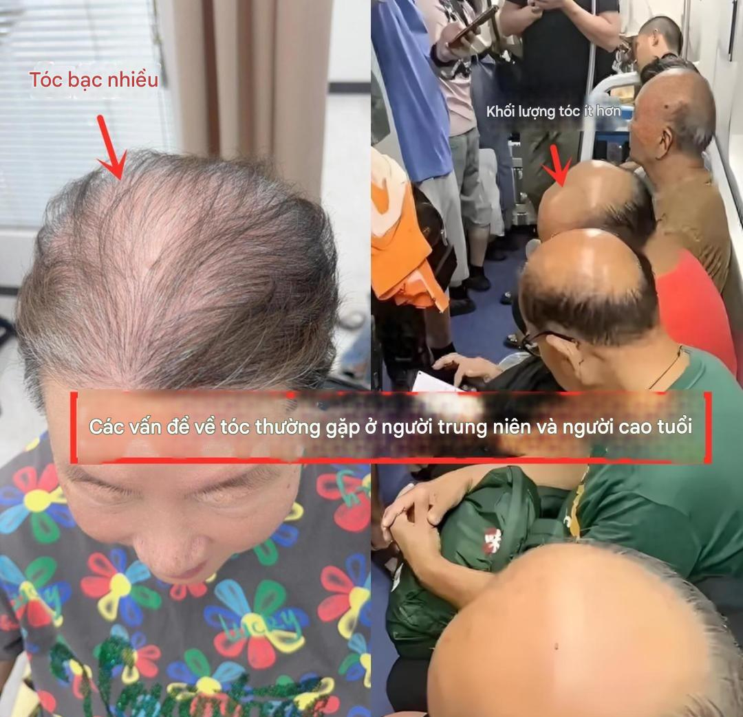 Kịch bản lừa đảo khiến người trung niên, cao tuổi tin sái cổ: Giấu con cháu mua hàng, tài khoản bốc hơi!- Ảnh 1.