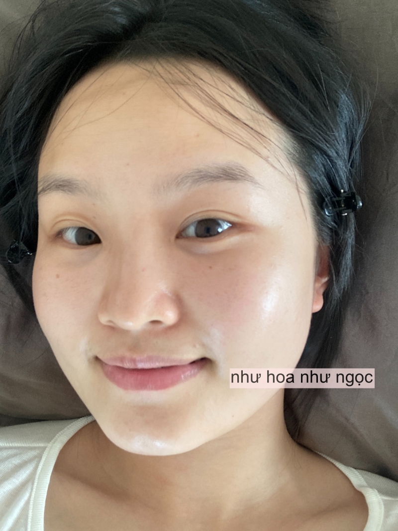 Uống thôi chưa đủ, làn da tuổi 30+ sẽ cần thêm bước này để “đẩy” collagen vào sâu- Ảnh 4.