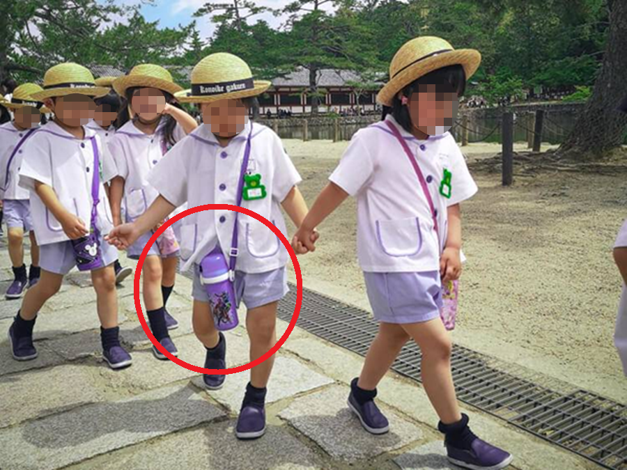 Đeo bình nước bên người, bé trai phải cắt bỏ tụy và lá lách- Ảnh 1.