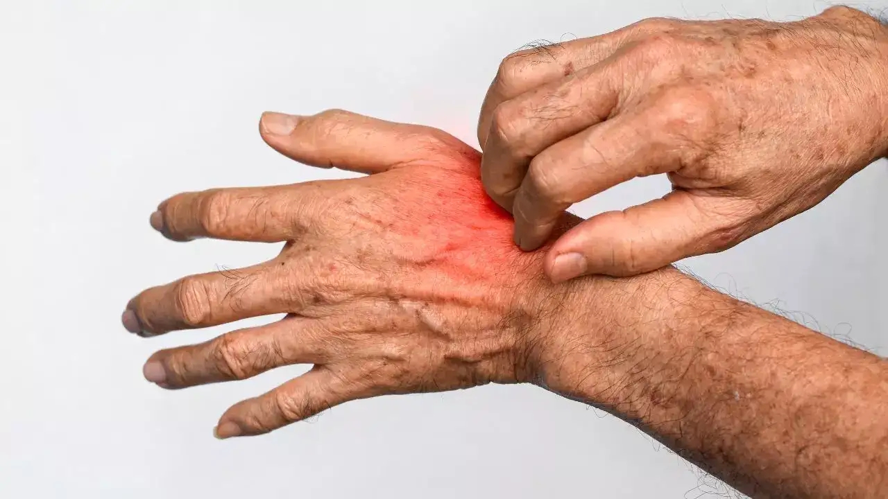 Sáng ngủ dậy thấy 5 dấu hiệu này, cẩn trọng vì có thể thận đang "lâm nguy": Có 1 cũng cần đi khám gấp- Ảnh 3. Sáng ngủ dậy thấy 5 dấu hiệu này, cẩn trọng vì có thể thận đang "lâm nguy": Có 1 cũng cần đi khám gấp- Ảnh 3.