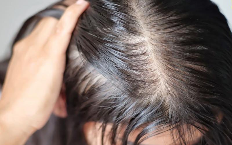 Tôi đã dùng thứ nước nhờn nhụa từ đậu bắp để ngăn tóc rụng 