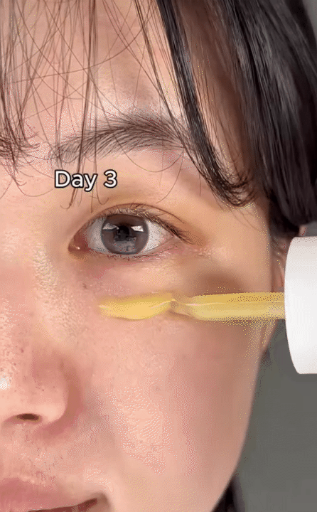 Lọ serum retinol 0.2% khiến beauty blogger Hàn bất ngờ về khả năng 