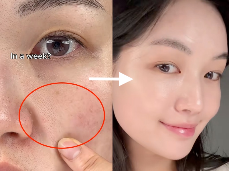 Lọ serum retinol 0.2% khiến beauty blogger Hàn bất ngờ về khả năng 