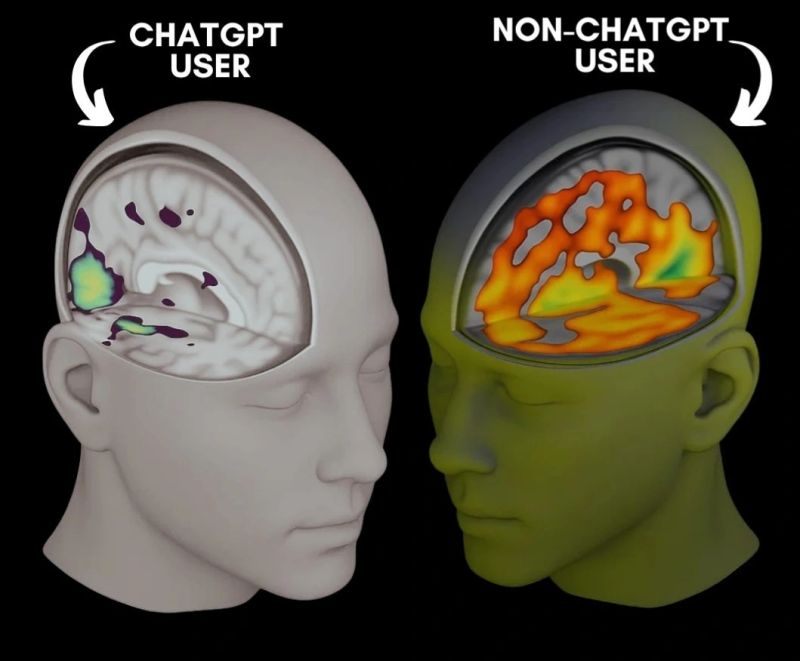 Lần đầu quét não người dùng ChatGPT, MIT phát hiện điều khiến cả thế giới chấn động- Ảnh 1.
