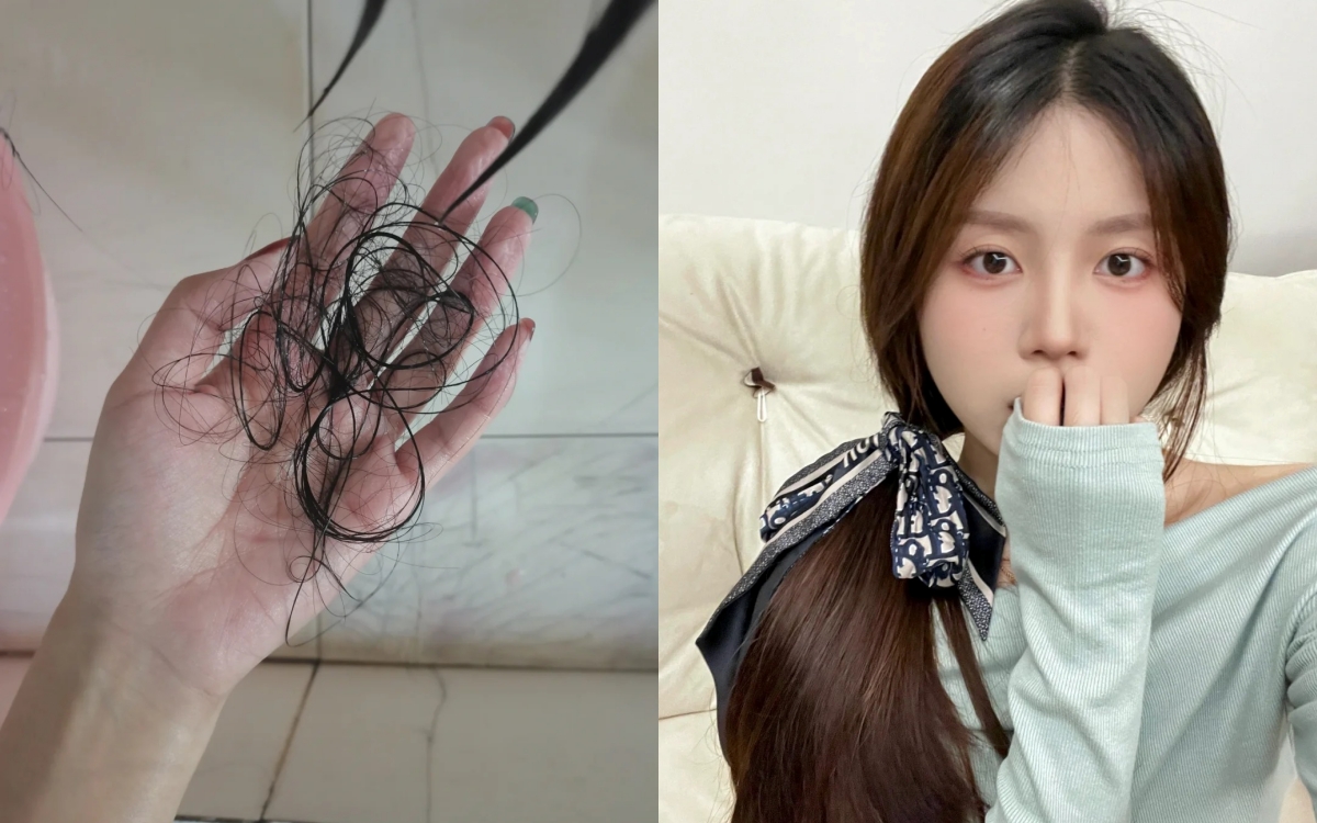 7 sai lầm khiến tóc rụng lả tả- Ảnh 1.