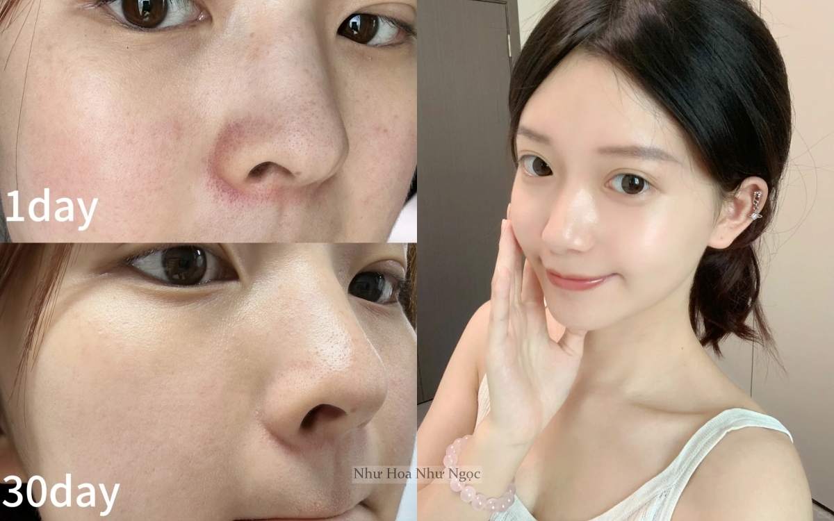 Không chạy theo xu hướng da "trắng sứ", tuổi 35+ tôi nhận ra rằng chỉ cần dưỡng đúng cách thì da sẽ sáng mịn từ bên trong- Ảnh 1.