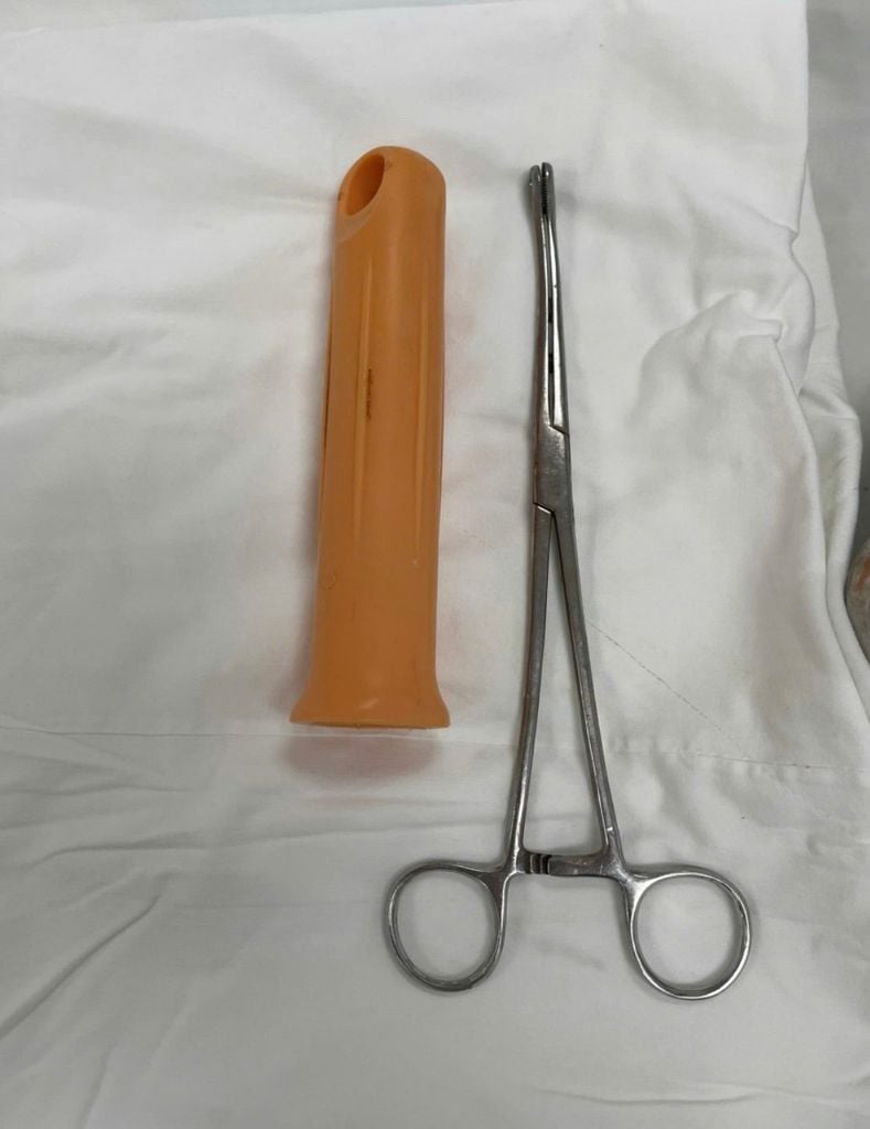 Cấp cứu nam thanh niên 23 tuổi ở TP.HCM bị kẹt cán cây lau nhà khoảng 15cm trong hậu môn- Ảnh 1.