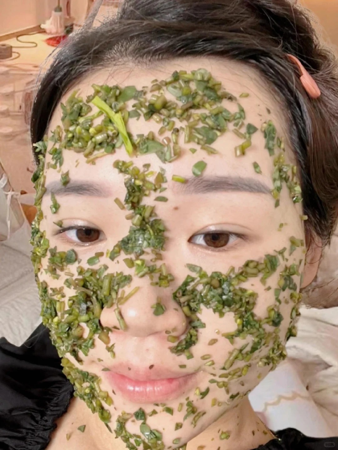 Tôi đắp rau sam mỗi ngày và nám mờ dần đi lúc nào không hay- Ảnh 2.