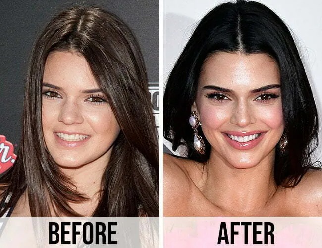 Nhà Kardashian - Jenner bị bóc mẽ nhan sắc giả dối: Từ mẹ đến con đều 