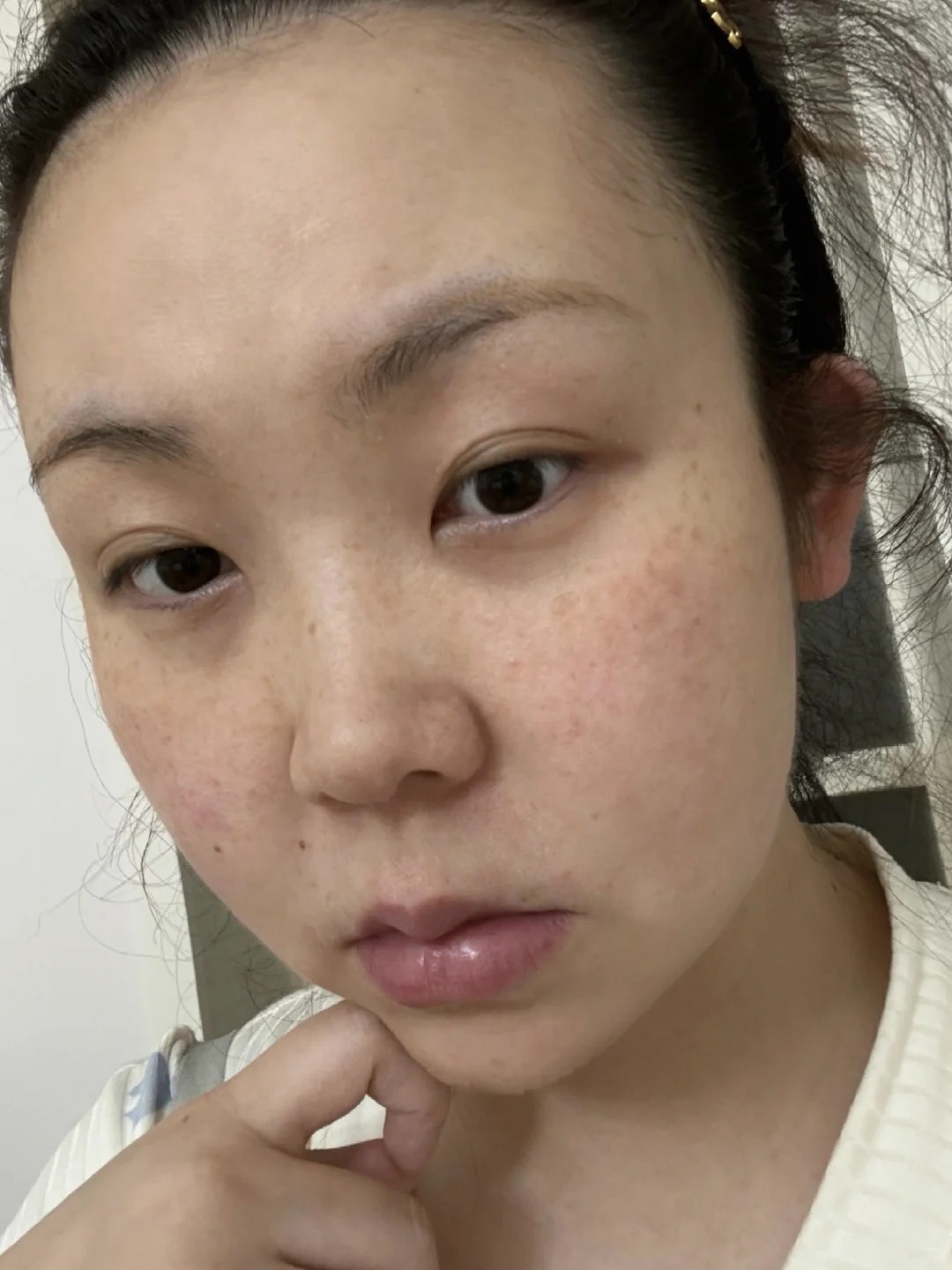 Tôi đắp rau sam mỗi ngày và nám mờ dần đi lúc nào không hay- Ảnh 3.