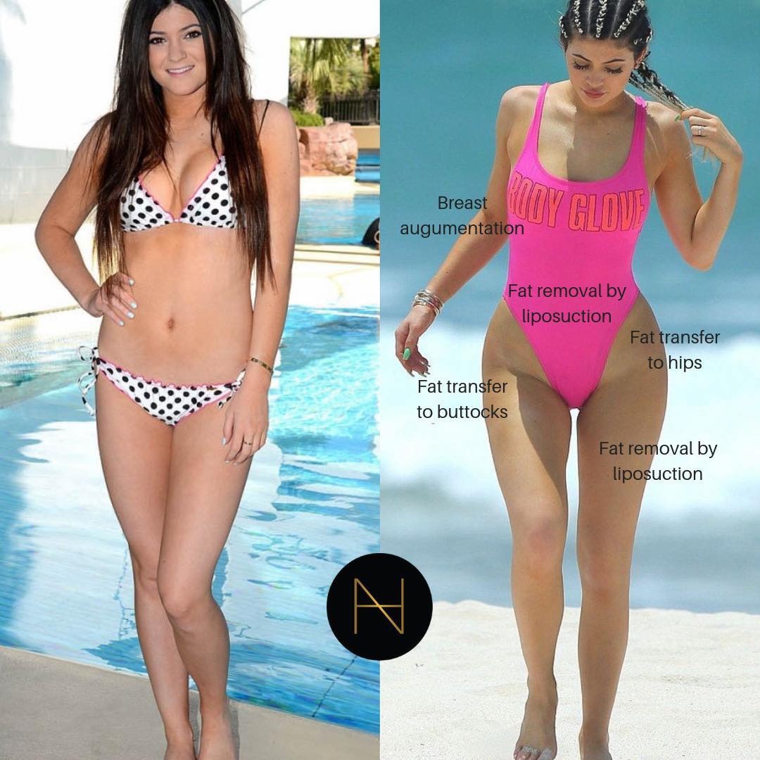 Nhà Kardashian - Jenner bị bóc mẽ nhan sắc giả dối: Từ mẹ đến con đều 