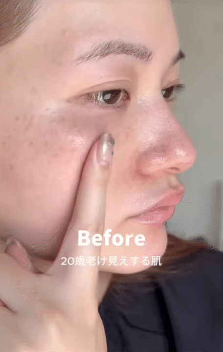 Cách trị nám của phụ nữ Nhật: Chỉ thêm một bước đơn giản mà sau 1 tuần da sáng bật tông- Ảnh 2.