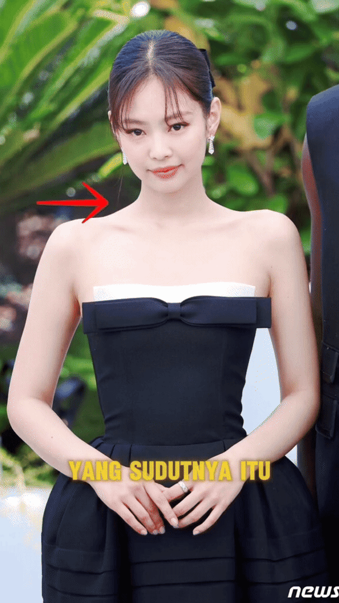 Rộ trào lưu tiêm vai móc áo giống Jennie- Ảnh 5.