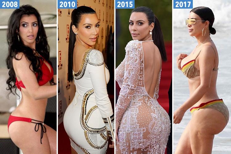 Nhà Kardashian - Jenner bị bóc mẽ nhan sắc giả dối: Từ mẹ đến con đều 