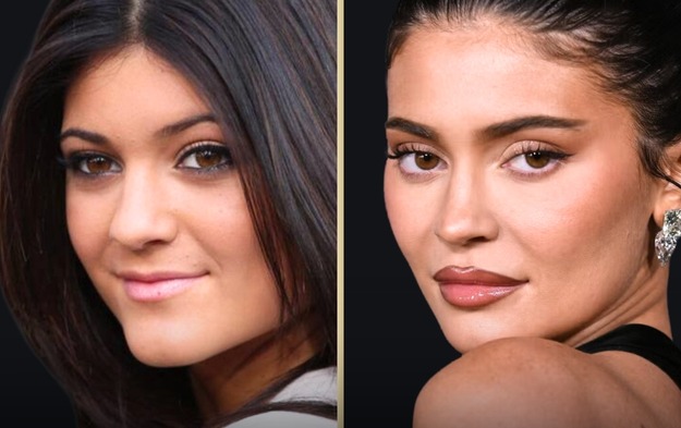 Nhà Kardashian - Jenner bị bóc mẽ nhan sắc giả dối: Từ mẹ đến con đều 
