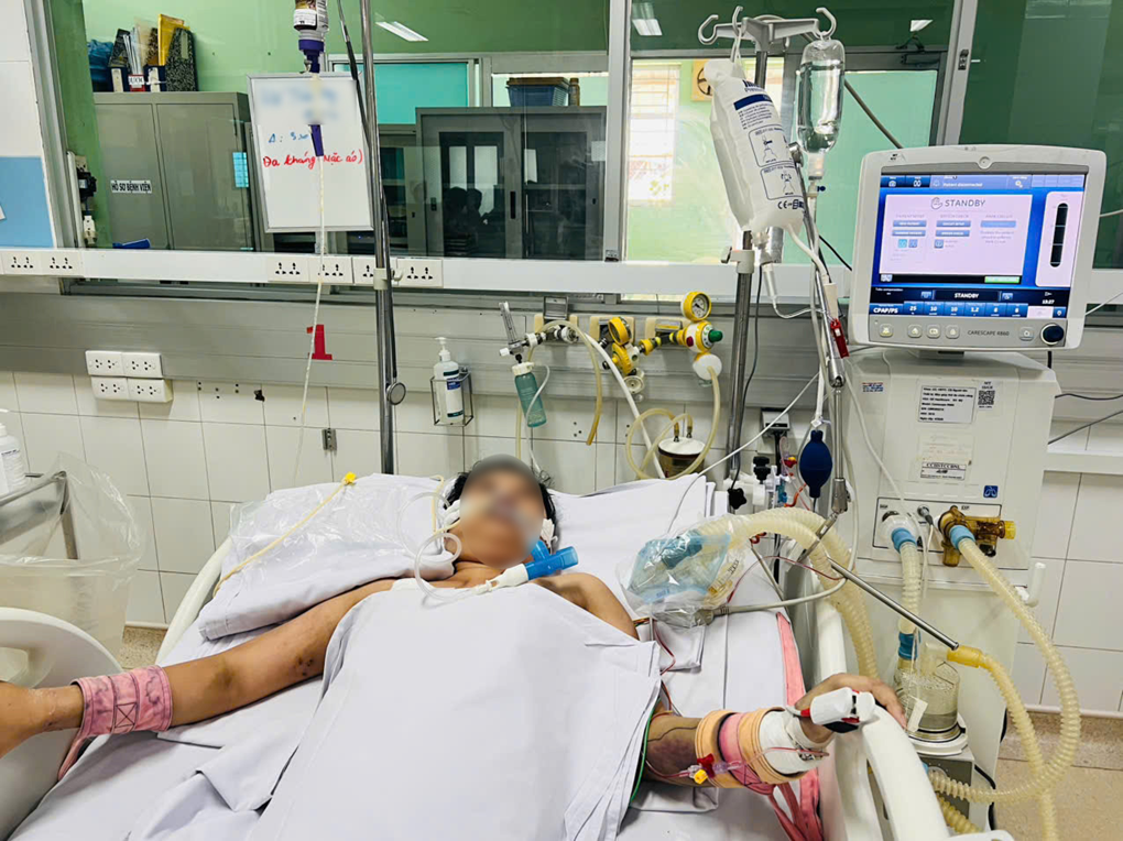 2 bệnh nhân trẻ ở TP.HCM suy đa cơ quan, nguy kịch vì sốt xuất huyết nặng- Ảnh 2.