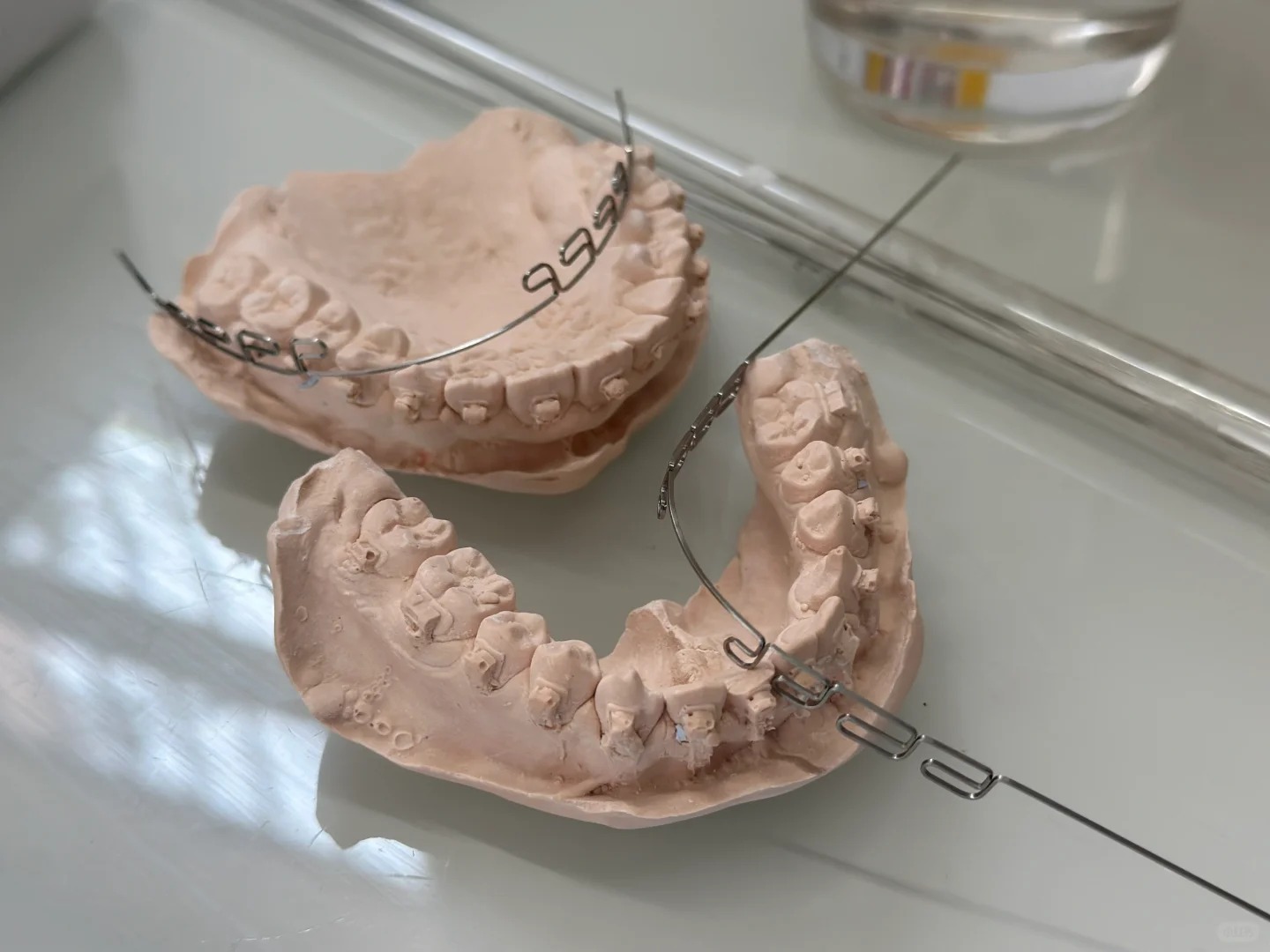 Chỉnh nha kiểu Meaw - Geaw: Vì sao được giới trẻ săn đón?- Ảnh 2.