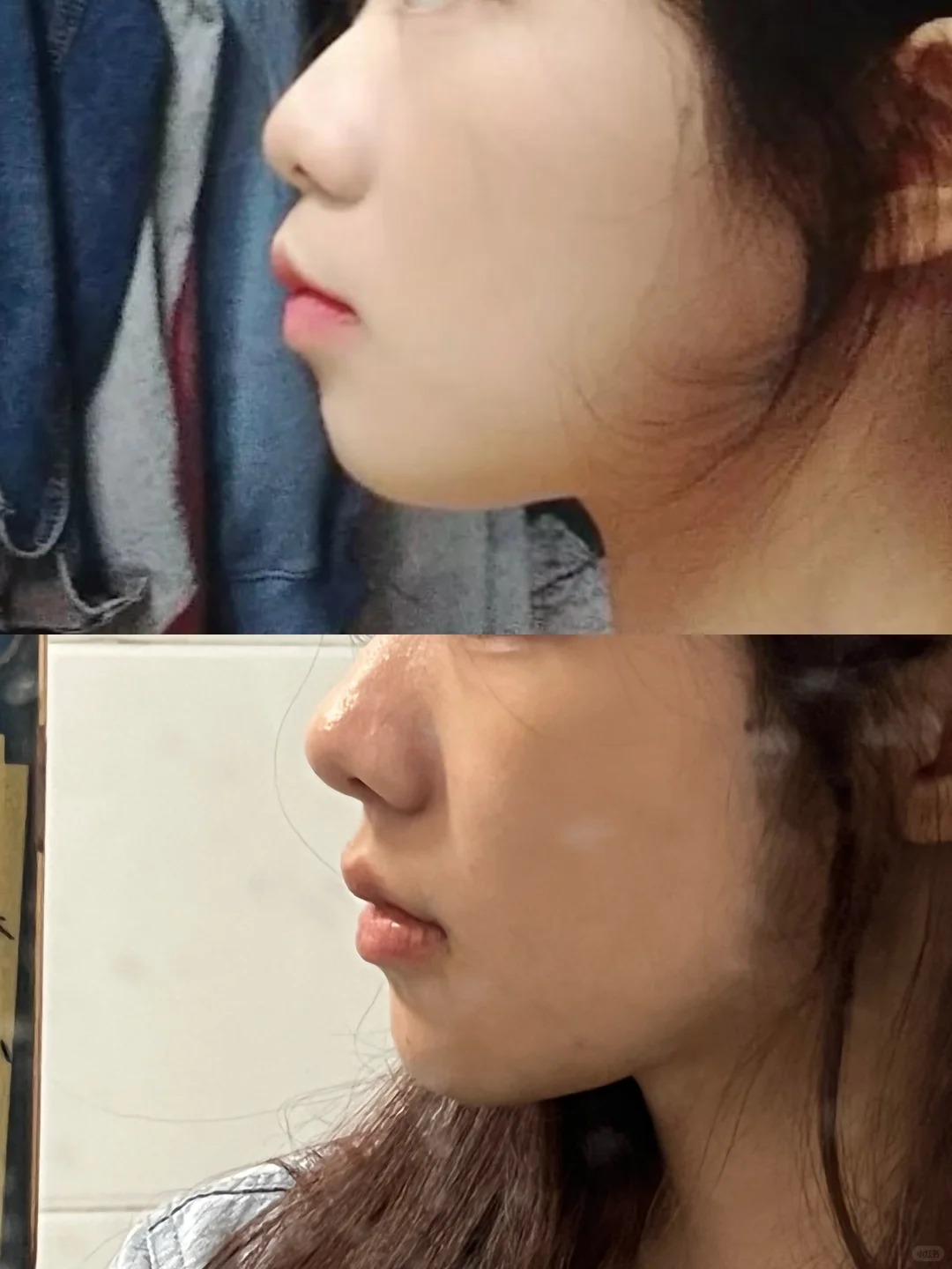 Chỉnh nha kiểu Meaw - Geaw: Vì sao được giới trẻ săn đón?- Ảnh 4.