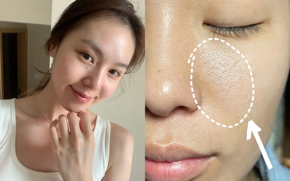 Lỗ chân lông nhỏ đi thấy rõ sau 1 tháng cô nàng này dùng bộ đôi serum dưỡng da bình dân của Hàn- Ảnh 1.
