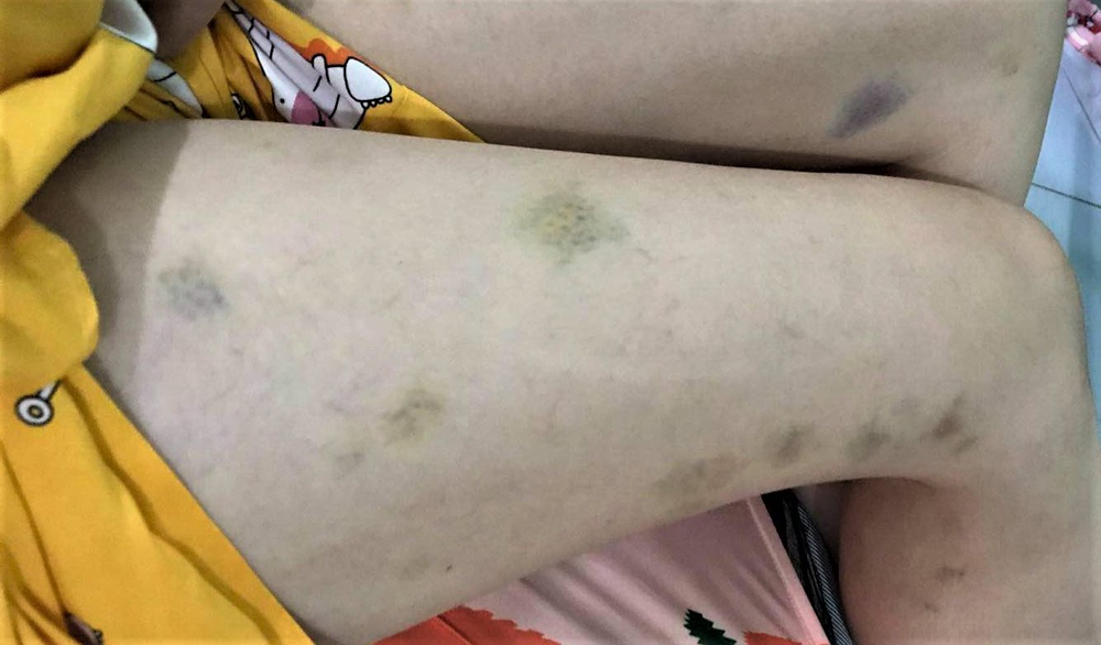 Nếu trong người có 5 cảm giác này thì XIN CHIA BUỒN, có thể bạn đã mắc loại ung thư từng là "trend" trong phim Hàn Quốc- Ảnh 2.