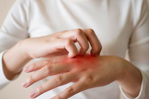 Đi khám vì bị ngứa khắp người, người phụ nữ sốc nặng trước thông báo của bác sĩ- Ảnh 1.