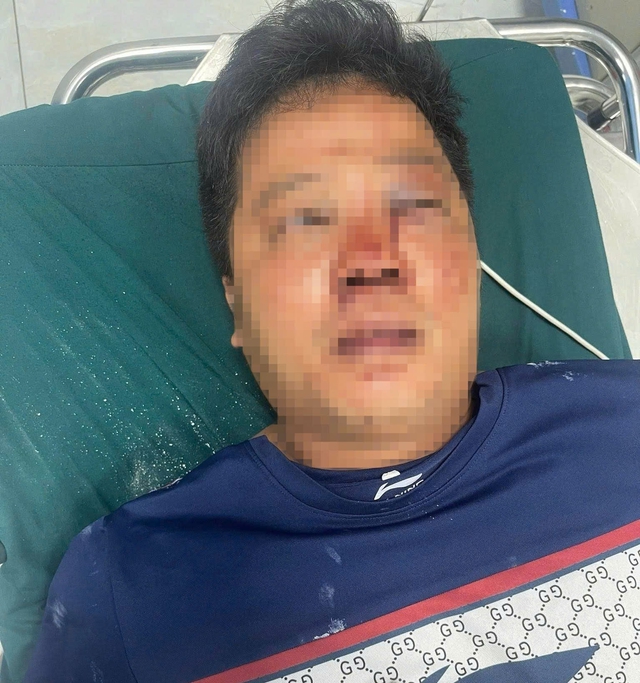Vụ 2 anh em bị đánh trọng thương khi cứu người: Chân dung đối tượng ra tay- Ảnh 4.