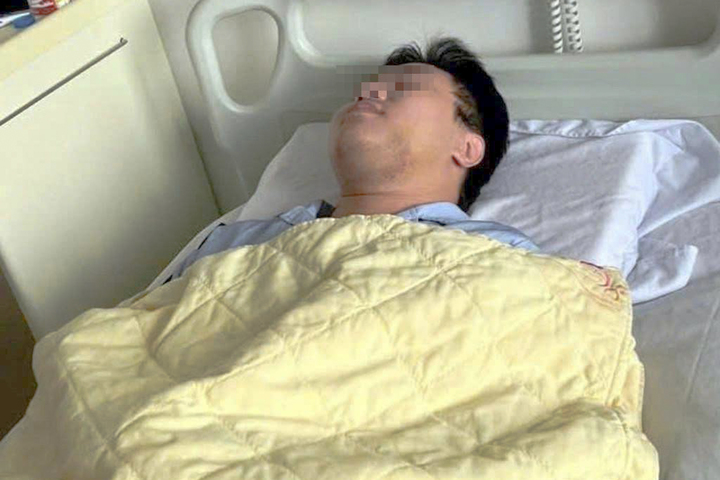 Chỉ vì 'ánh mắt', nam sinh Hà Nội bị đánh gãy xương hàm giữa ban ngày- Ảnh 2.