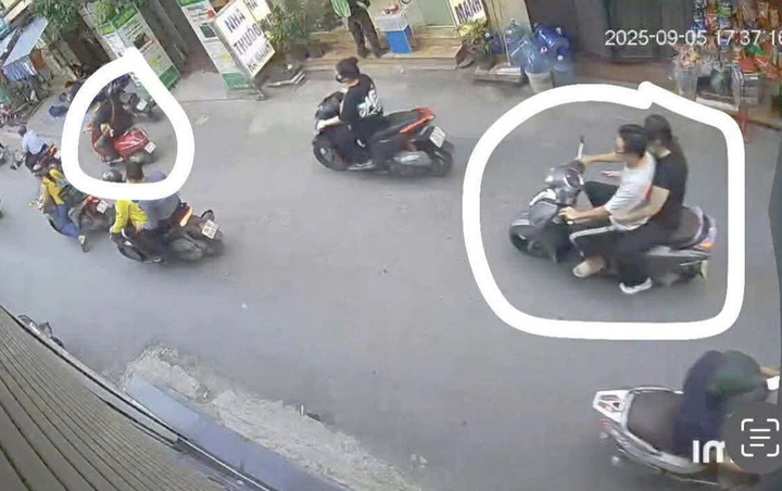Chỉ vì 'ánh mắt', nam sinh Hà Nội bị đánh gãy xương hàm giữa ban ngày- Ảnh 1.