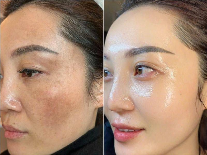 Sai lầm tồi tệ khi dùng Retinol suýt banh mặt, từ đáy lòng khuyên bạn đừng dẫm vào "vết xe đổ" này- Ảnh 2.