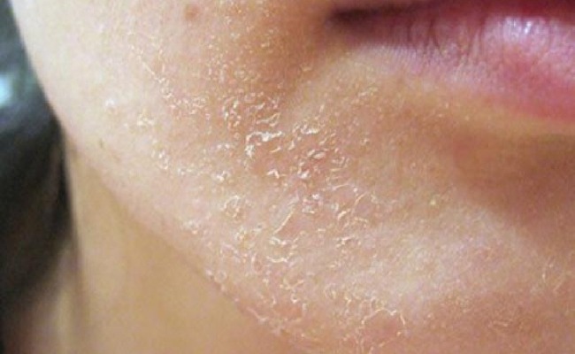 Sai lầm tồi tệ khi dùng Retinol suýt banh mặt, từ đáy lòng khuyên bạn đừng dẫm vào "vết xe đổ" này- Ảnh 1.