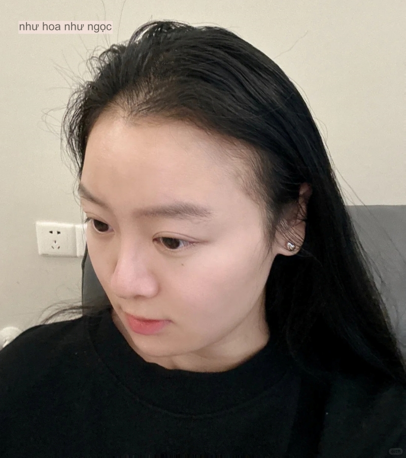 Tôi mất 5 năm để biến mái tóc thưa thớt trở nên dày dặn và bồng bềnh trở lại- Ảnh 4.