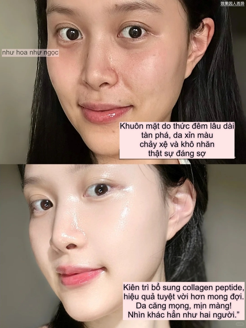 Tôi gần 30 tuổi nhưng vẫn bị nhầm là thực tập sinh: Bí quyết của tôi chính là collagen peptide- Ảnh 1.