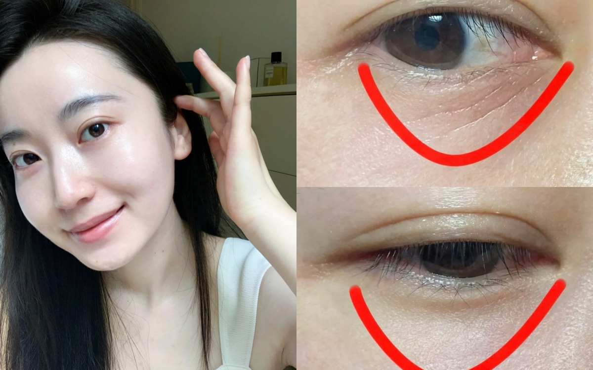 5 lọ serum retinol dành cho người mới: Êm ái, nhẹ nhàng mà vẫn "sửa nếp nhăn" cực đỉnh- Ảnh 1.