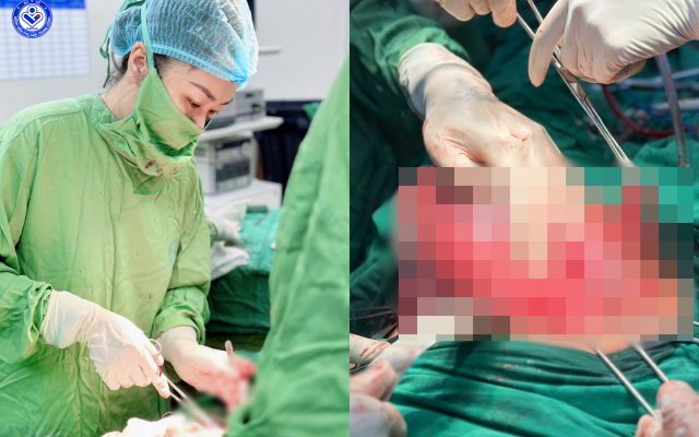 Mổ cấp cứu cho sản phụ mang thai 34 tuần có ruột thừa vỡ mủn nát: Ca mổ liên viện cứu sống cả hai mẹ con trong gang tấc- Ảnh 1.